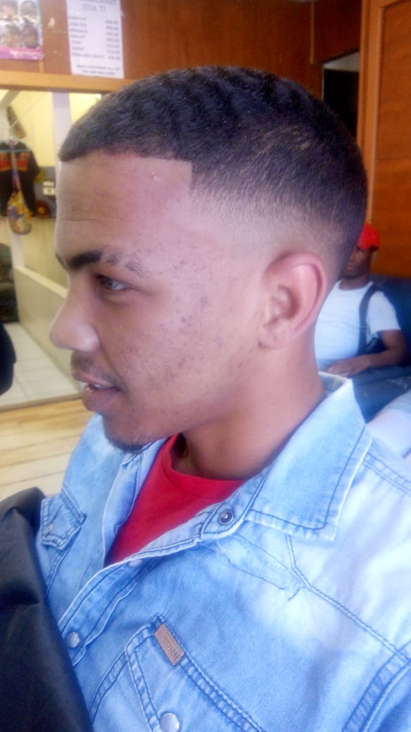 cuts